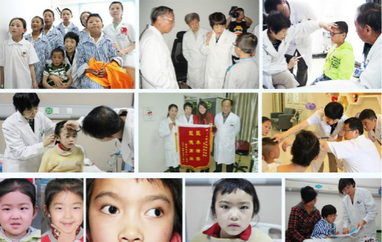 小孩斜弱视如何？